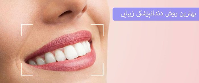 بهترین روش دندانپزشکی زیبایی
