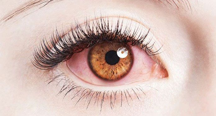 با 7 عواقب پاک نکردن آرایش چشم بیشتر آشنا شوید