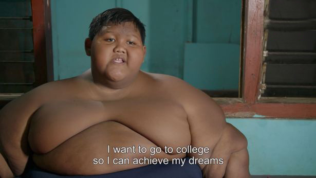 چاقی این پسر جوان و خطر ترکیدنش (عکس)